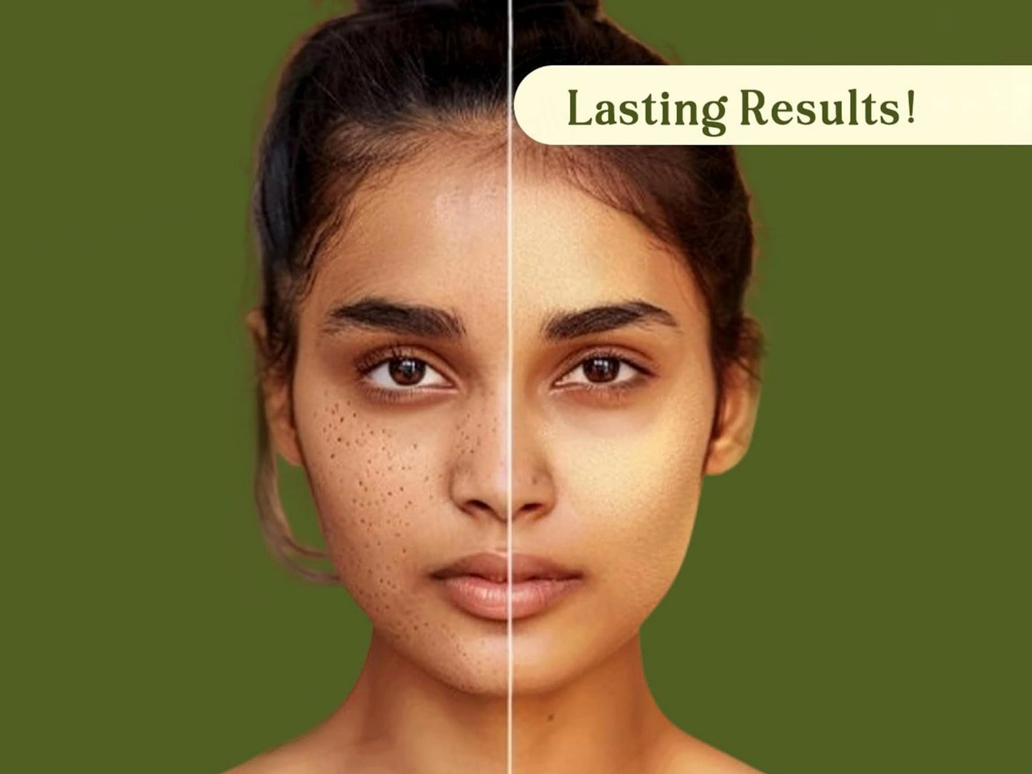 Suun Ayurveda Phyto Pore Refiner Face Serum