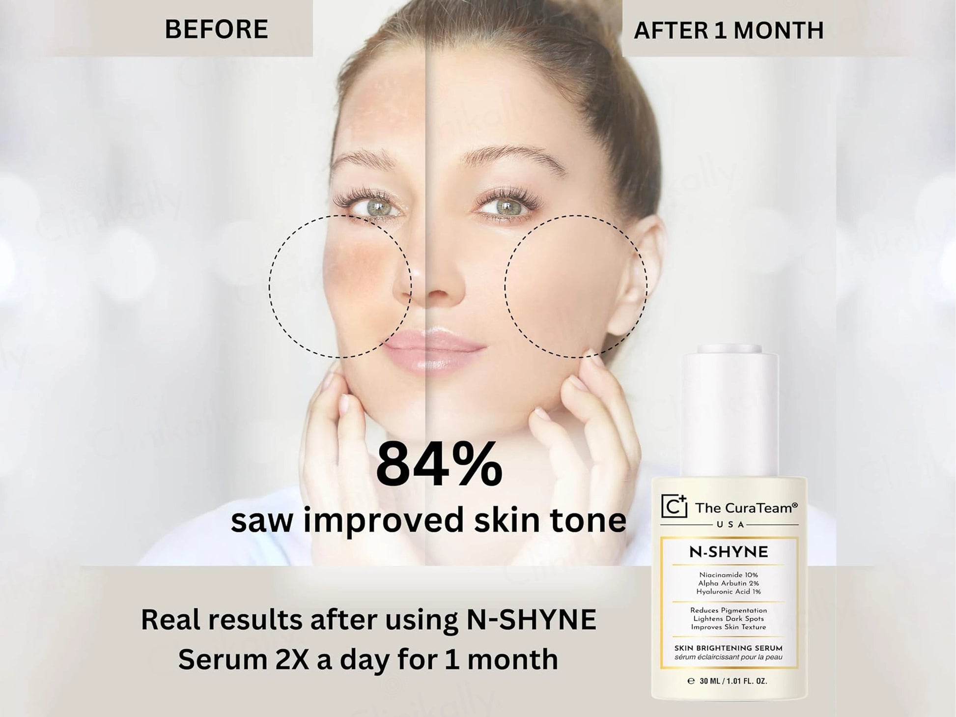 The CuraTeam N-Shyne Skin Brightening Serum