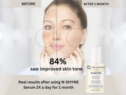 The CuraTeam N-Shyne Skin Brightening Serum