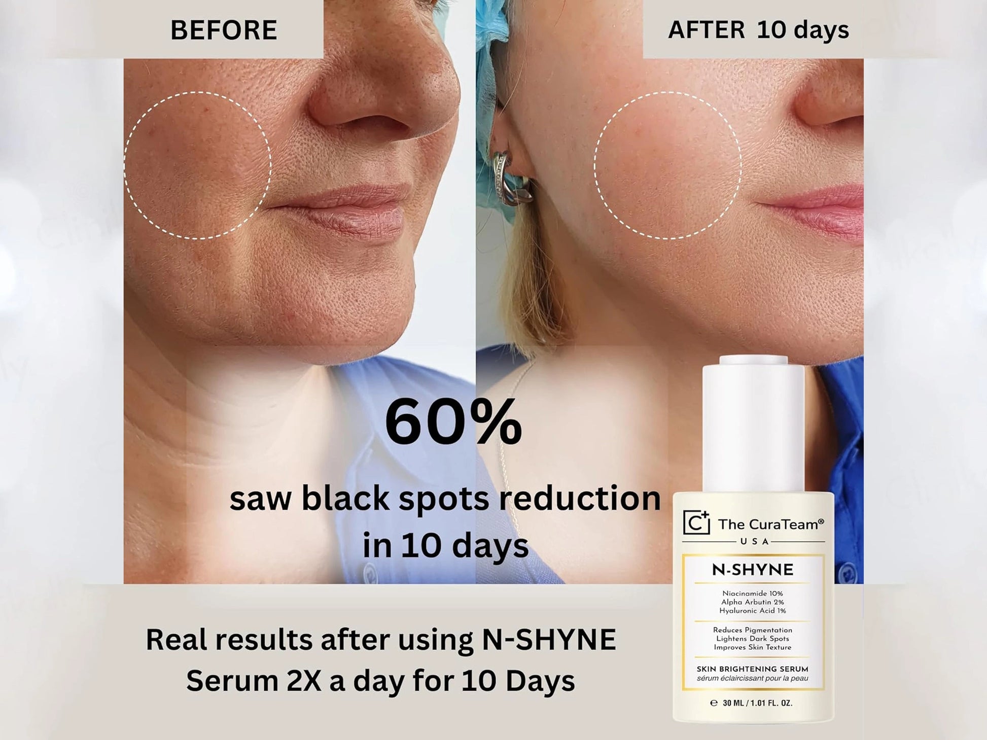 The CuraTeam N-Shyne Skin Brightening Serum