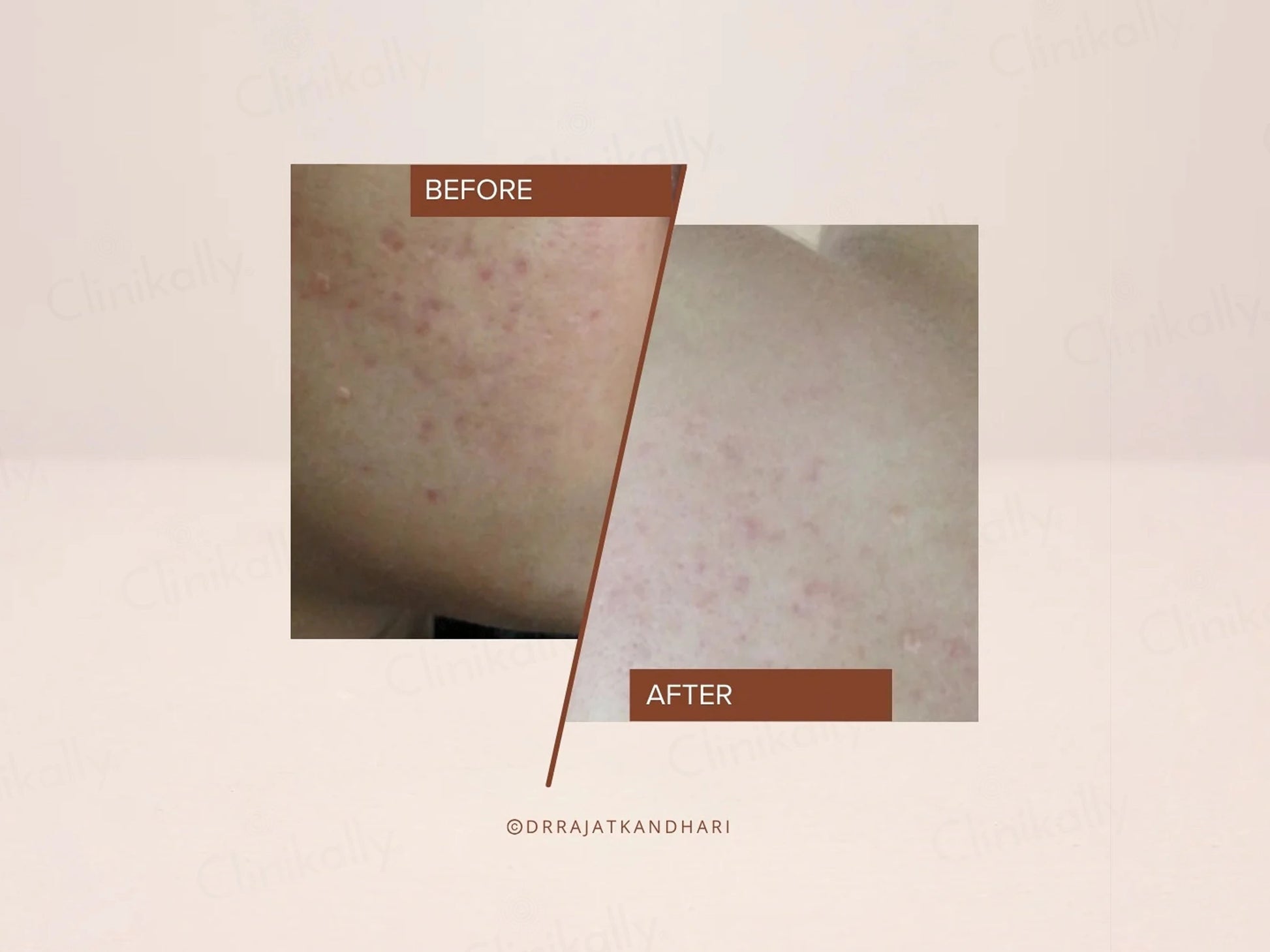 The Facecraft Project Clean Gentle Face Wash and  Mask