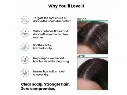 The Skin Story Anti Dandruff Shampoo