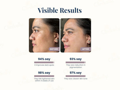 Uniqaya Retinol Serum