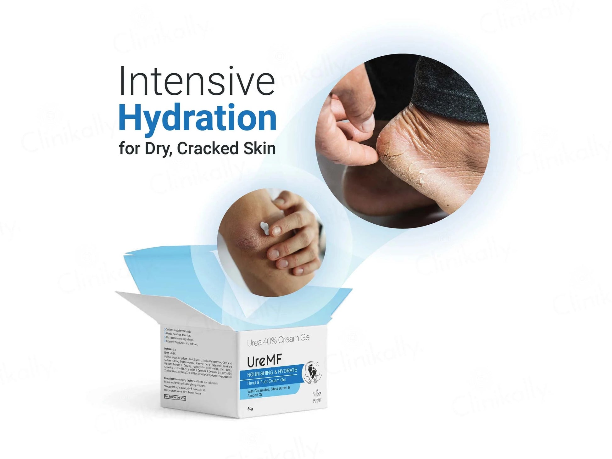 UreMF 40 Percent Urea Hand and  Foot Cream Gel