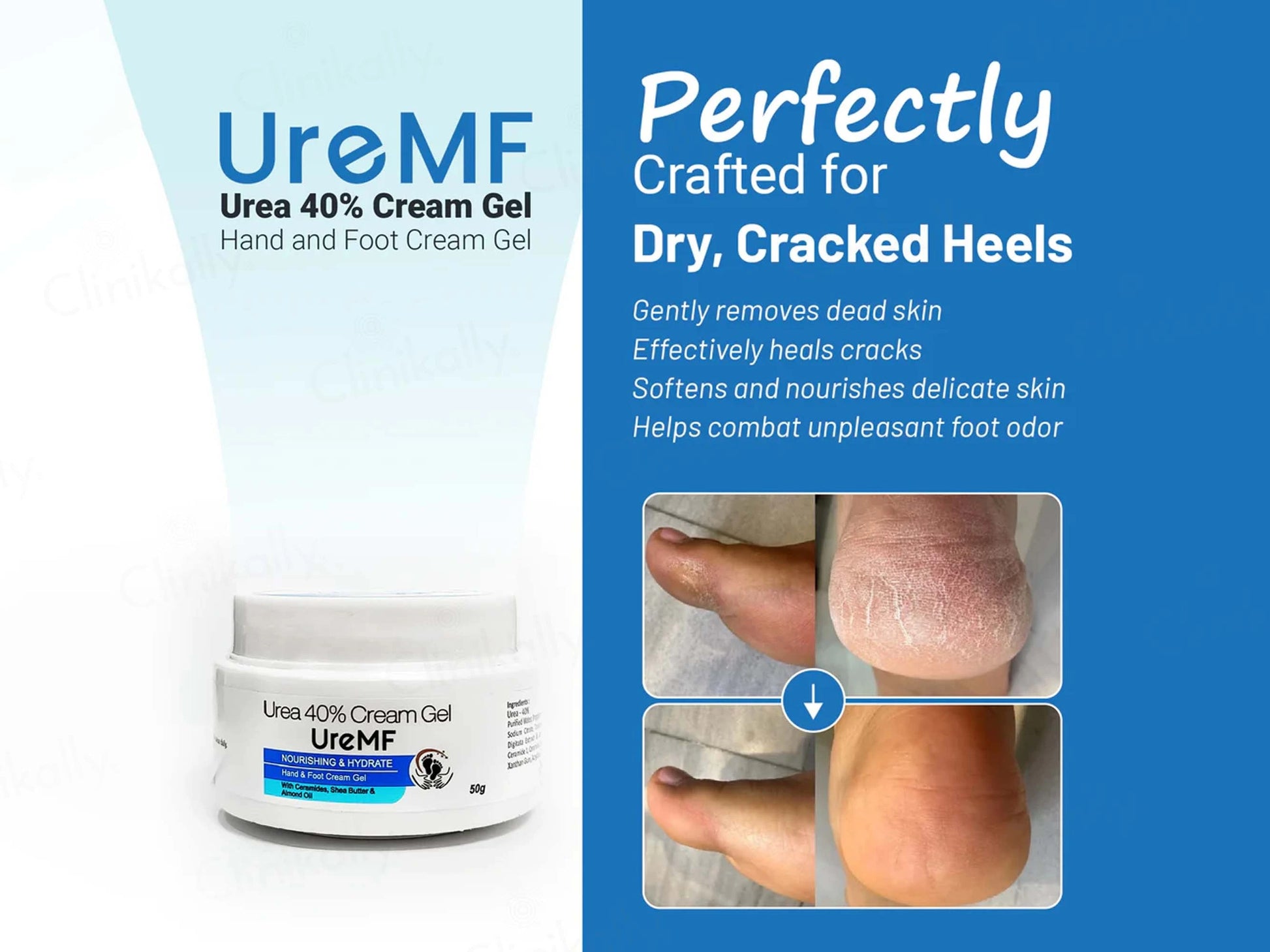 UreMF 40 Percent Urea Hand and  Foot Cream Gel