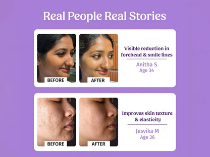 Vilvah Store Better Ageing Overnight Skin Renewal Face Serum