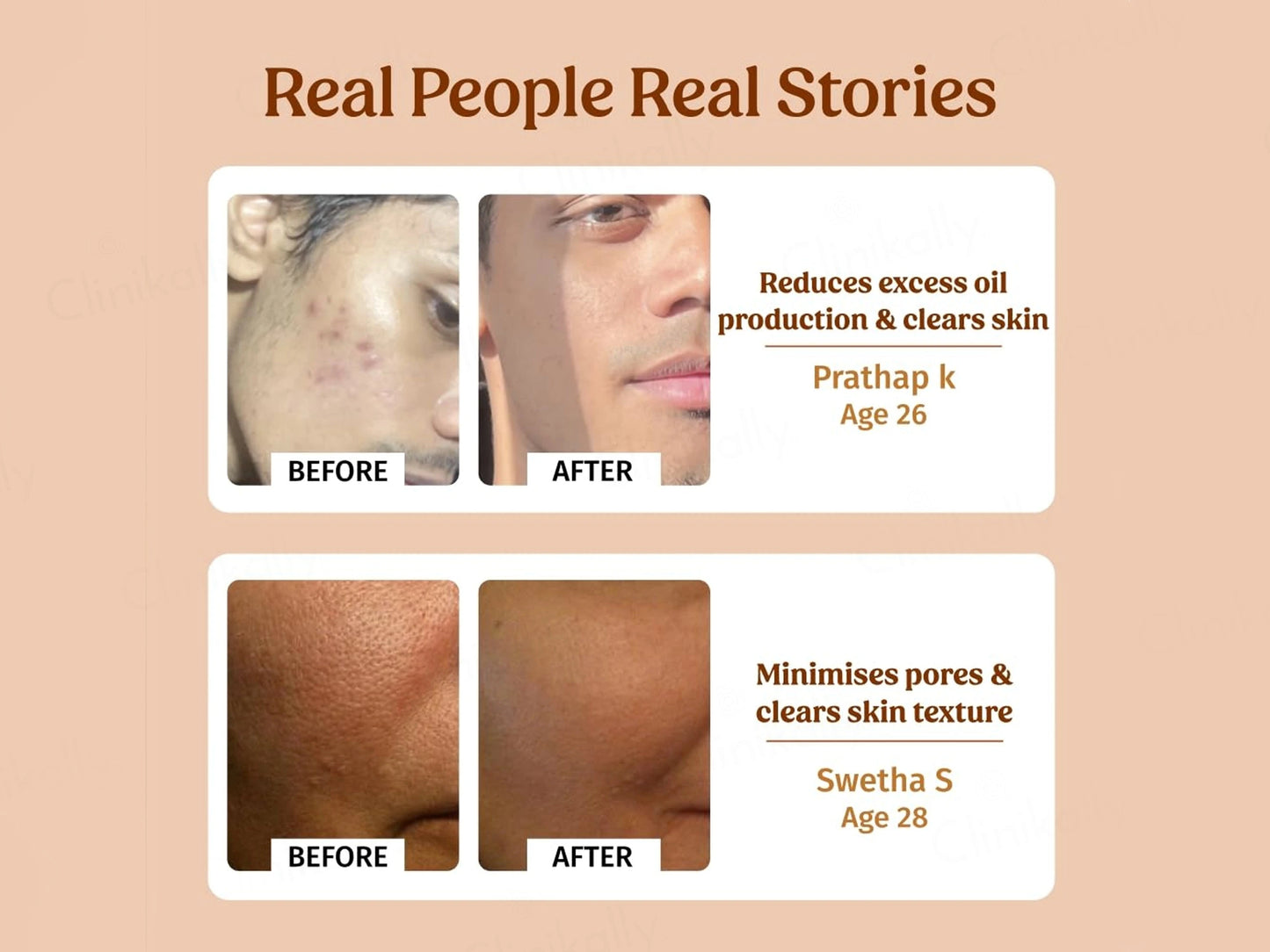 Vilvah Store Milk Facial Toner