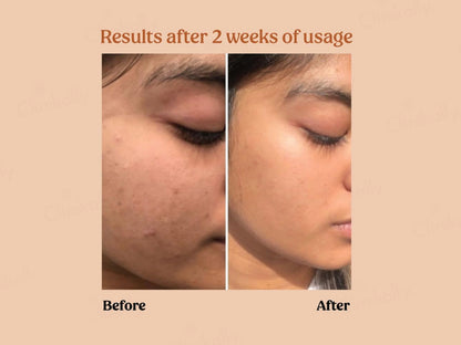 Vilvah Store Milk Powder Face Wash