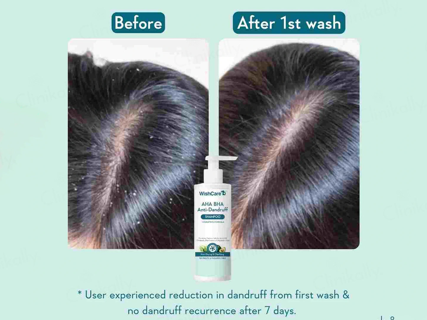 WishCare AHA BHA Anti-Dandruff Shampoo