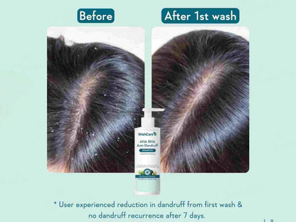 WishCare AHA BHA Anti-Dandruff Shampoo