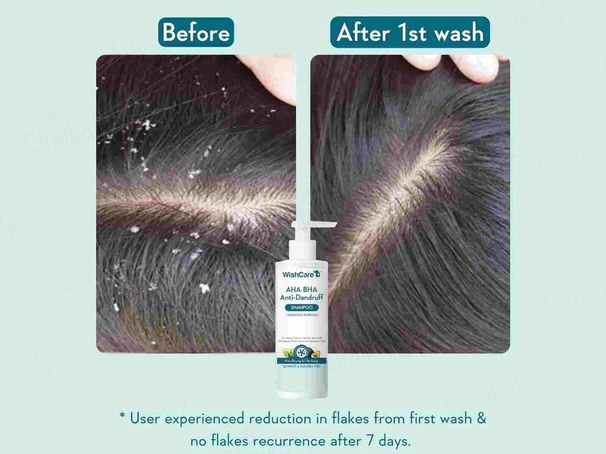 WishCare AHA BHA Anti-Dandruff Shampoo