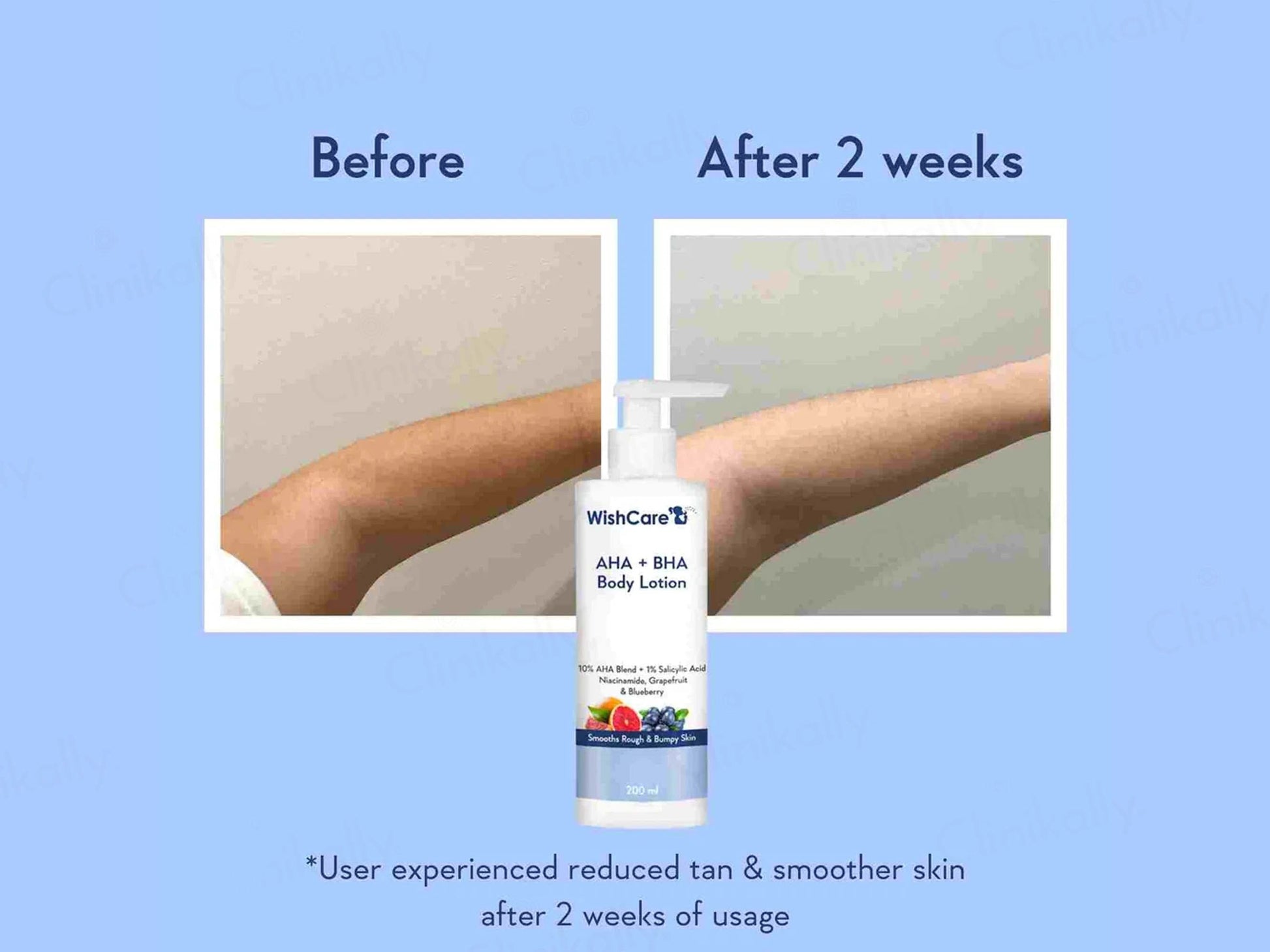WishCare AHA  BHA Body Lotion