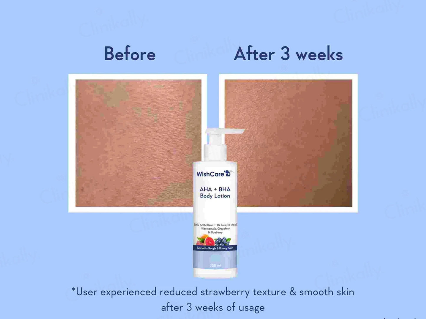 WishCare AHA  BHA Body Lotion