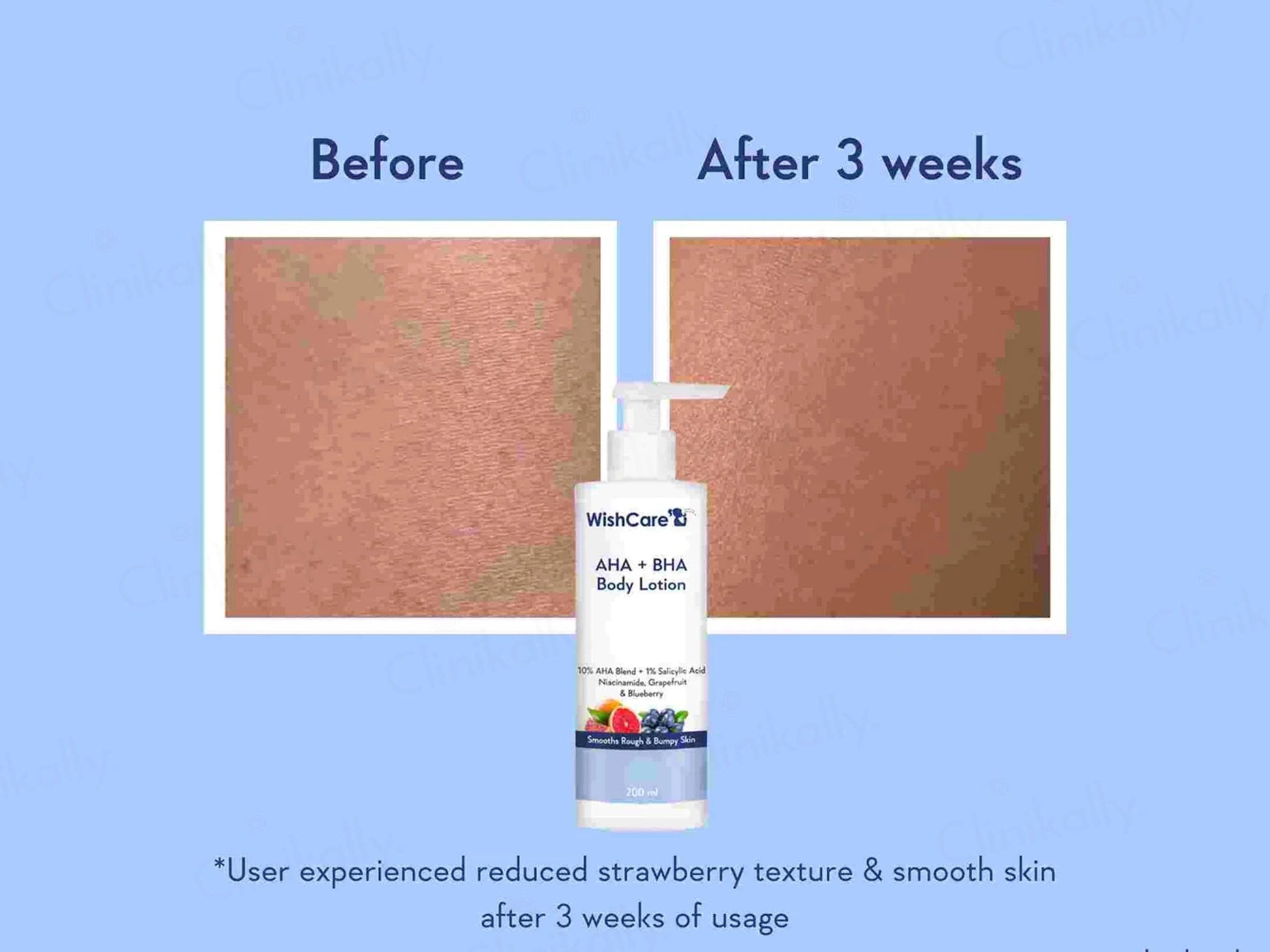 WishCare AHA  BHA Body Lotion