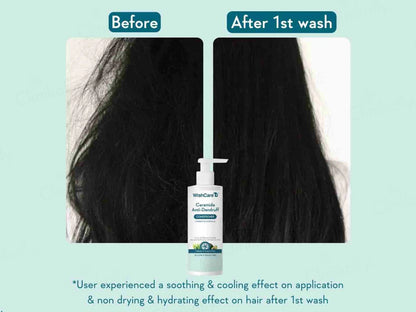 WishCare Ceramide Anti-Dandruff Conditioner