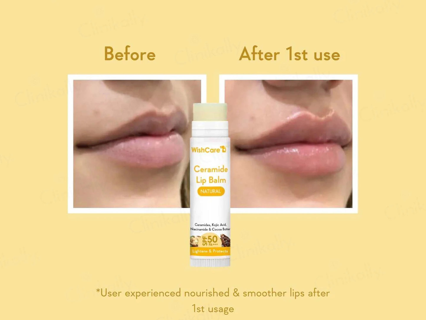 WishCare Ceramide Lip Balm - Natural SPF 50 PA
