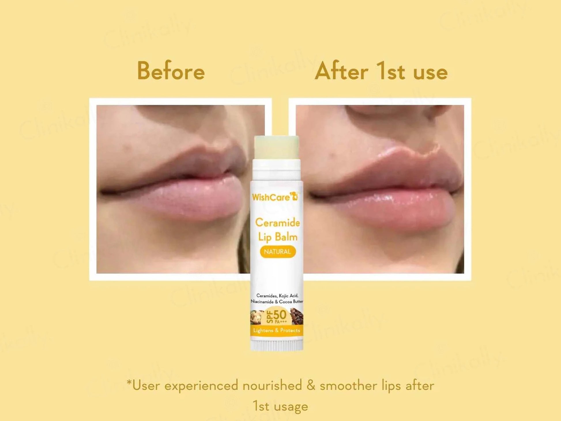 WishCare Ceramide Lip Balm - Natural SPF 50 PA