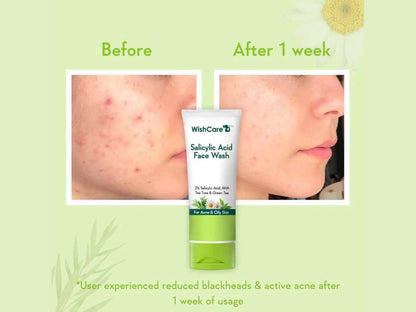 WishCare Salicylic Acid Face Wash
