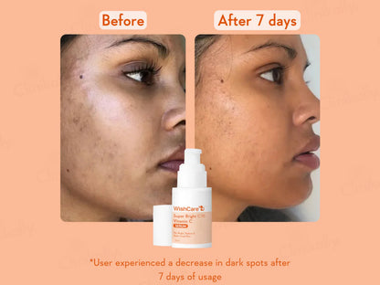 WishCare Super Bright C16 Vitamin C Serum