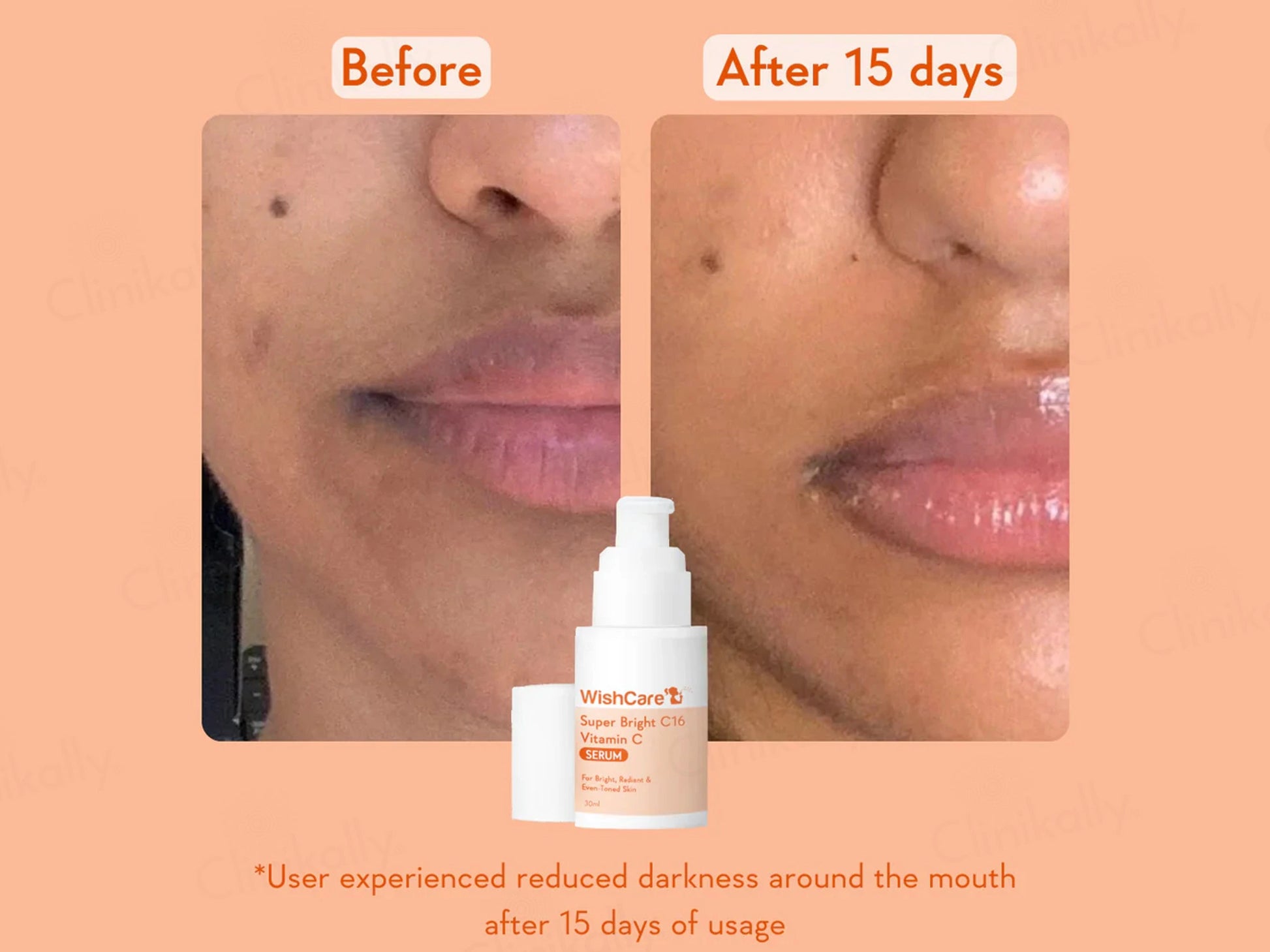 WishCare Super Bright C16 Vitamin C Serum