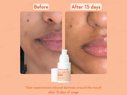 WishCare Super Bright C16 Vitamin C Serum