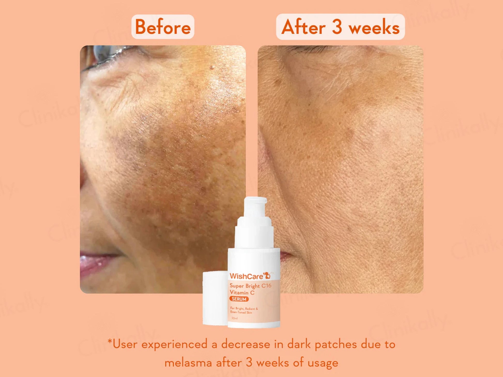 WishCare Super Bright C16 Vitamin C Serum