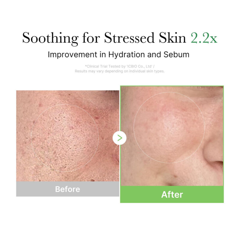 Medicube Exosome Cica Tea Tree Cream For Sensitive Skin With Centella Asiatica Help Reduce Redness And Breakouts. | Low-Irritating, Moisturizing Daily Texture Care | Korean Skincare | 1.7 Fl Oz - Image 3