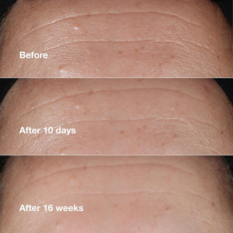 Clinique Smart Clinical Repair Wrinkle Correcting Face Serum With Hyaluronic Acid, Peptides + Advanced Retinoid Serum | Anti-Aging + Hydrating - Image 4
