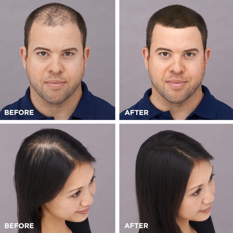 Toppik Hair Building Fibres Black 12g - Image 4